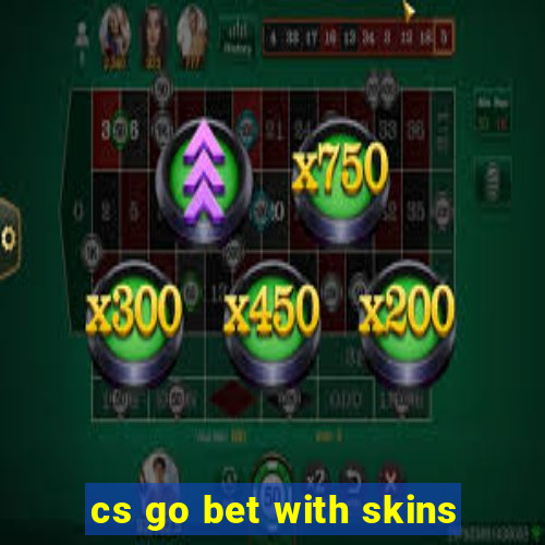 cs go bet with skins