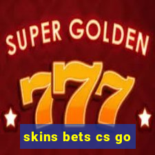 skins bets cs go