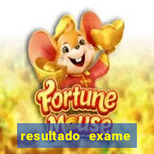 resultado exame eliel figueiredo