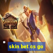 skin bet cs go