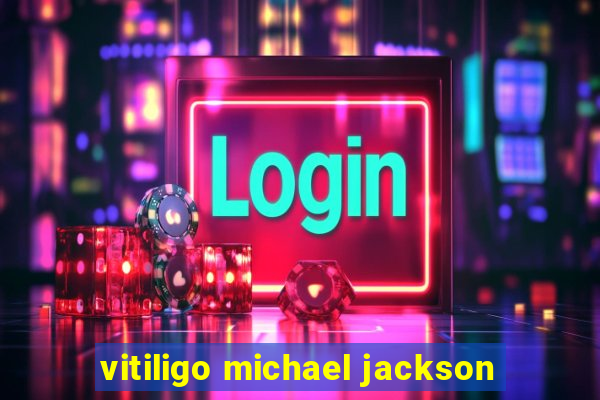 vitiligo michael jackson