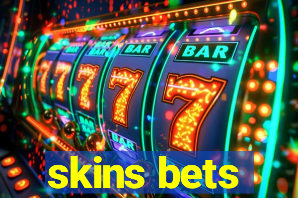 skins bets