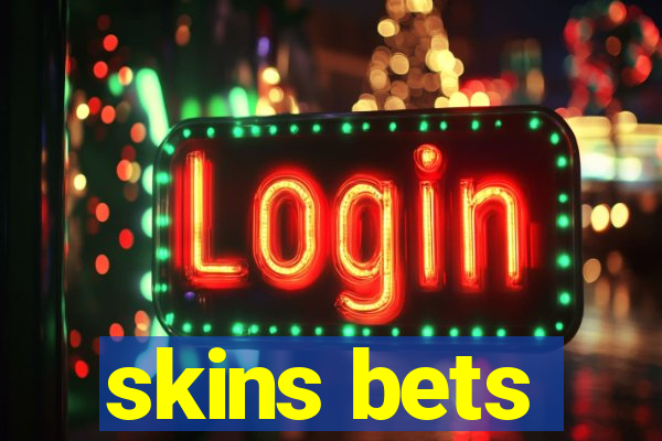 skins bets