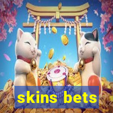 skins bets