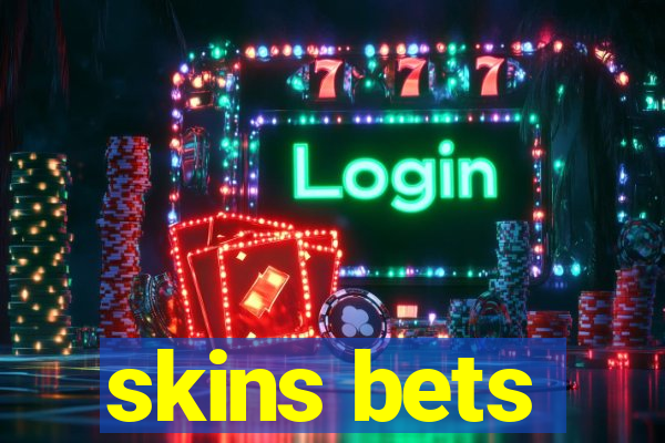 skins bets